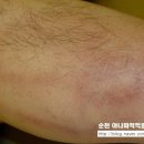 아나파의원 Daum카페
