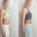 이오에너지 | [이오팻주사 후기] 겨울철 다이어트는 이렇게… 청담동피부과 상체관리 꾸준히 하는 이유