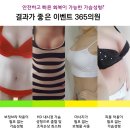 이벤트365의원 이미지