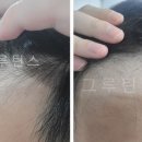 비포애프터 - 고양시 일산서구 탄중로 106 | 비포애프터