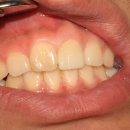 이지치과기공소 이미지