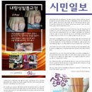 손톱쟁이 이미지