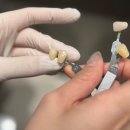 명 치과기공소 이미지