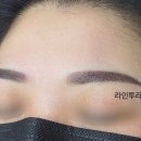 라인투라인