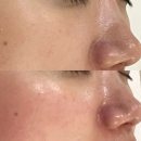 신영프라자 | 분당피부관리추천 피부장벽재건전문샵 휘온에스테틱 분당 서현점 트로이필 후기