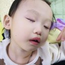 김옥영소아과 네이버블로그