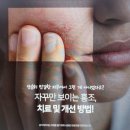 SC주미안피부과의원 네이버블로그