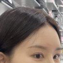 피코 | 눈썹문신제거 피코레이저 후기 통증·딱지·회복과정 총정리