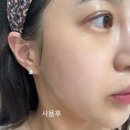 미드에센스 | 비엘리아 스킨 리페어 PDRN마스크팩 사용후기 물광피부 수분감좋은팩