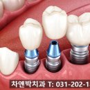 차앤박치과의원 | 수원스케일링치과 편안하게 받은 곳