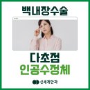 광주백내장 다초점 인공수정체 다양한 종류, 가격, 선택하는 방법까지 이미지