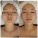 빛의전신 | 대구 달서구 현풍 웨딩경락&웨딩관리💆🏻‍♀️_빛의 전신 솔직방문후기✒️✨