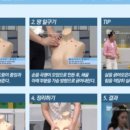 엣지테라피 이미지