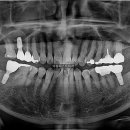 퍼스트치과기공소 이미지