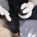 대전에스테틱 탄방동 프롬미유 샤프팅 이중턱 관리후기
