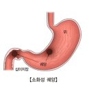 위 이미지