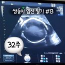 (주)세일정밀기계 | 쌍둥이 임신 일기 13. 대학병원 후기 정밀초음파 제왕절개 날짜 출산일 확정 (임신 32주)