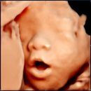 수원-2056 | 임신후기 33주 아기초음파 아기얼굴, 아기크기, 남편 백일해주사맞는 팁