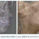 좋은미소치과의원 이미지