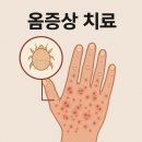 옴