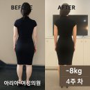 (주)에버셀 | [40대 여성 마운자로 4주차 -8kg 감량 후기] 마운자로와 통합치료로 비만잡는 아리아 여성의원