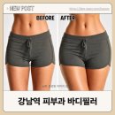 바디라인 | 골반 필러과 러브핸들 온다 리프팅 조합｜강남 피부과 베르나의원, 바디라인 관리 내돈내산 후기
