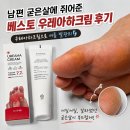아하 | 남편 굳은살에 쥐어준 베스토 우레아하크림 후기 (우레아하크림으로 여름 발관리)