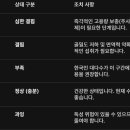 비타민 D 이미지