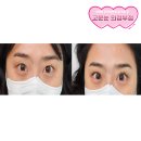 고운:눈 의정부점