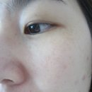 닥터뷰 원샷 엔자임 크림 클렌져 후기(with코스인사이드)