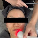 디엠스킨 | 물방울리프팅, 울디엠 3000샷 리얼 후기! 서울대입구역 스킨케어는 여기