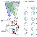 Re:Re: 시각 경로의 이해 visual system 이미지