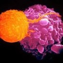 복막전이암의 항암치료가 별로 효과가 없는 이유는 무엇인가? 이미지