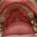 루트치과기공소 이미지