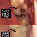 내이치과기공소 이미지