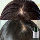 다나한헤어 | 다나한 초담은 두피열 쿨링샴푸 여름철 대용량 탈모샴푸 추천 (비포애프터 O)