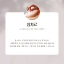 두침한의원 | 부천 옥길동한의원 침치료를 맞는 이유? 침치료의 좋은점?