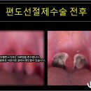 재성치과의원 | 수면무호흡수술 아이 잘때 땀 코가자주막힘 아침에 피곤한 증상