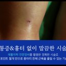 하피스의원 네이버블로그