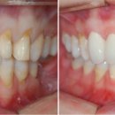 바른이치과기공소 이미지