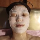 &#34;강남 썸에스테틱 스페셜 관리 후기: 크리스탈 필링과 광선 테라피 체험기&#34;