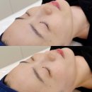 부산 온천장피부관리 잘하는 이터널스킨 슈퍼젝션 세멘시트 후기