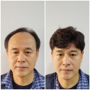 아빠미소 | 아빠가발 선물하고 10년 젊어진 미소 되찾아 드린 리얼 후기 (효도 대성공!)