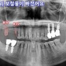 더에스플란트치과의원 이미지