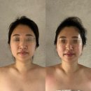 후앤유 | 노원피부관리 뷰티라보앤유, 붓기 싹 빠지고 등 펴진 후기