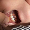 김태완아이봄치과의원 이미지