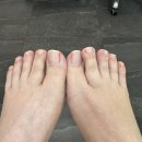 네일포시즌 레푸스 합정점 | 부산 사상 문제성 손발톱 교정 고민해결 레푸스 사상점