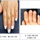 베이크네일