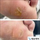 엠블케어 이미지