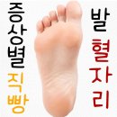 증상별 발 혈자리 이미지